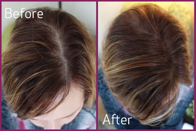 Kara Hair fiber before after