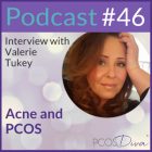 PCOS Podcast 46 - Acne